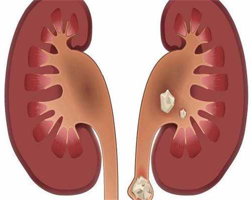 高龄试管助孕包男孩供卵套餐哪里好，看完收藏！捐卵代生机构