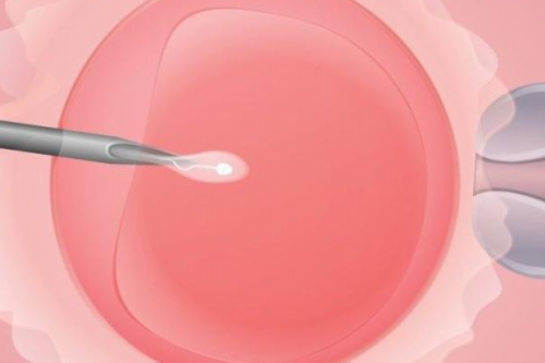 山东私人捐卵正规供卵费用正规代怀哪家专业