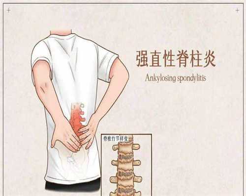 代孕产子机构包成功,哪些疾病需要切除子宫(盘点子宫切除的两大原因)