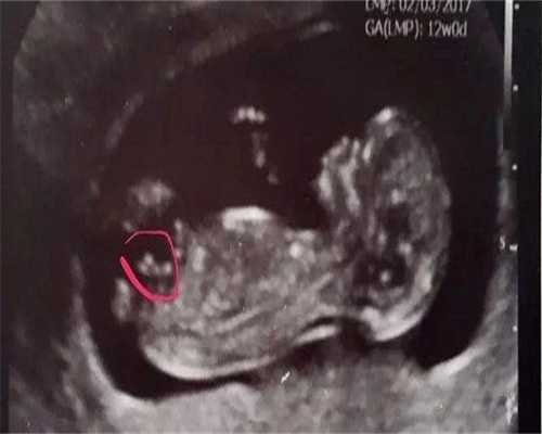 河北供卵龙凤胎现在有人供卵吗试管助孕包男孩代怀生子中心