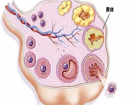 胎停必须做清宫吗？胎停育清宫手术需重视