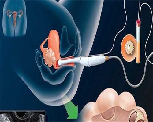 剖腹产后的饮食健康注意事项剖腹产后的饮食禁忌