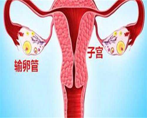 双侧巧克力囊肿怀孕几率是多少