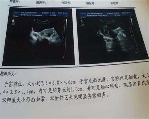 汕头试管婴儿一次能成功！试管助孕指南！