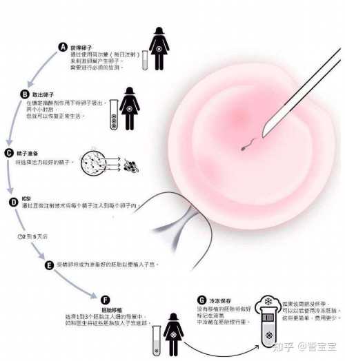 金华三代试管婴儿费用包含价格明细一览