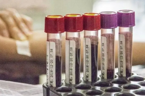 温州借卵子自怀,温州哪个医院做试管婴儿