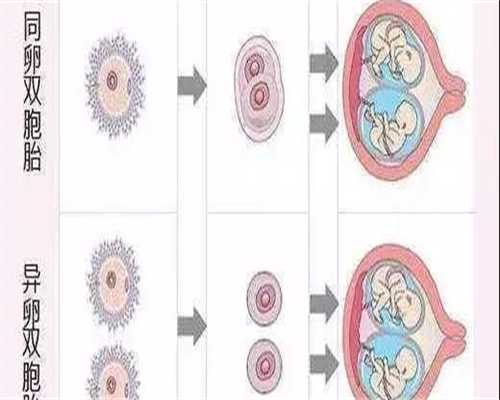 促排卵容易造成卵巢肌瘤吗？促排会长肌瘤吗？