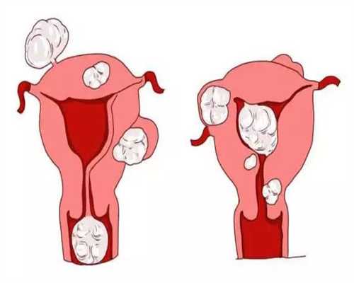 卵泡成熟排卵试纸测不到强阳（排卵试纸却测不到强阳）
