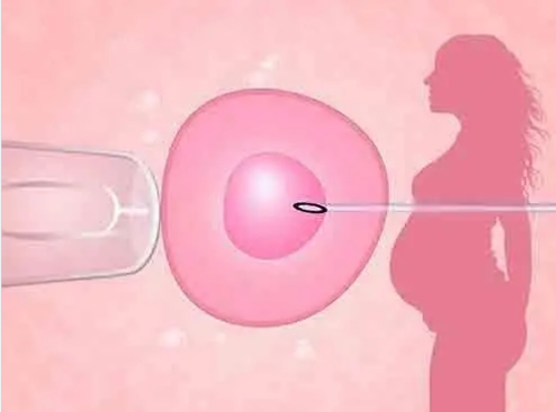 西安子宫内膜息肉可以试管移植吗